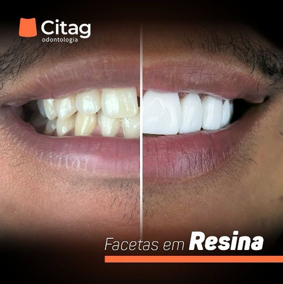 Banner Página Convênio - Citag